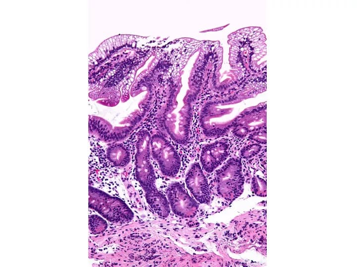 Nephron