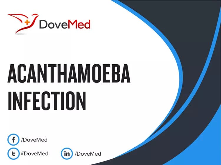 Is the cost to manage Acanthamoeba Infection in your community affordable?
