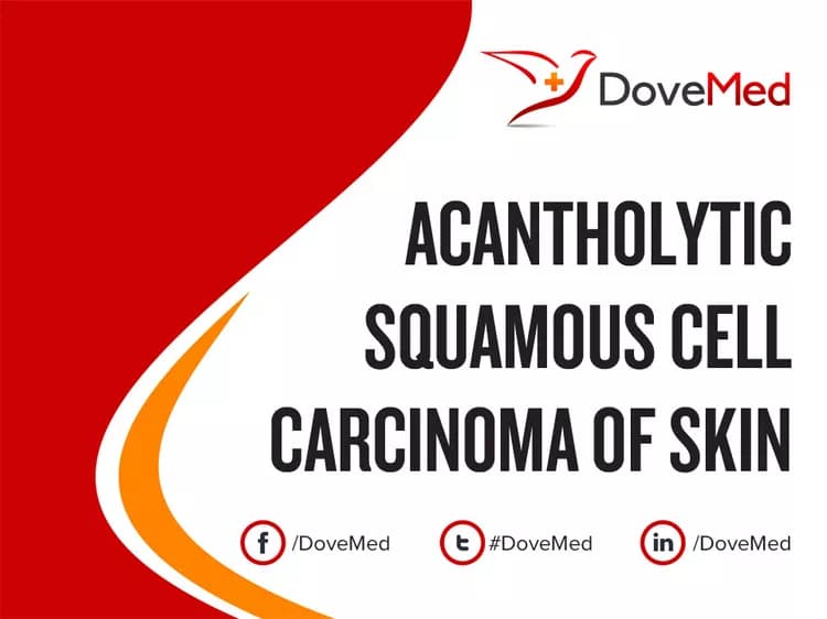 Can you access healthcare professionals in your community to manage Acantholytic Squamous Cell Carcinoma of Skin?