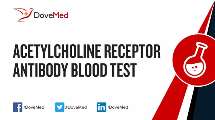 Acetylcholine Receptor Antibody Blood Test