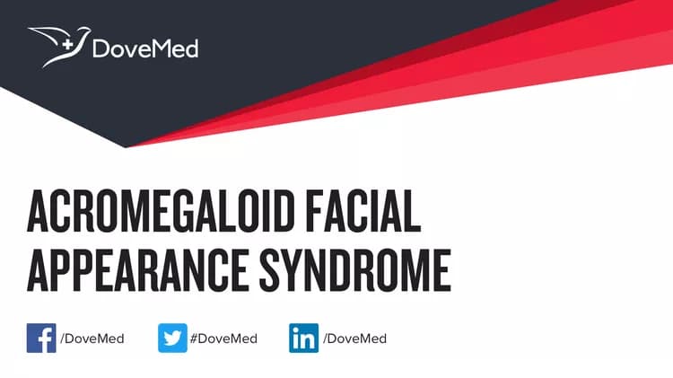 Can you access healthcare professionals in your community to manage Acromegaloid Facial Appearance Syndrome?