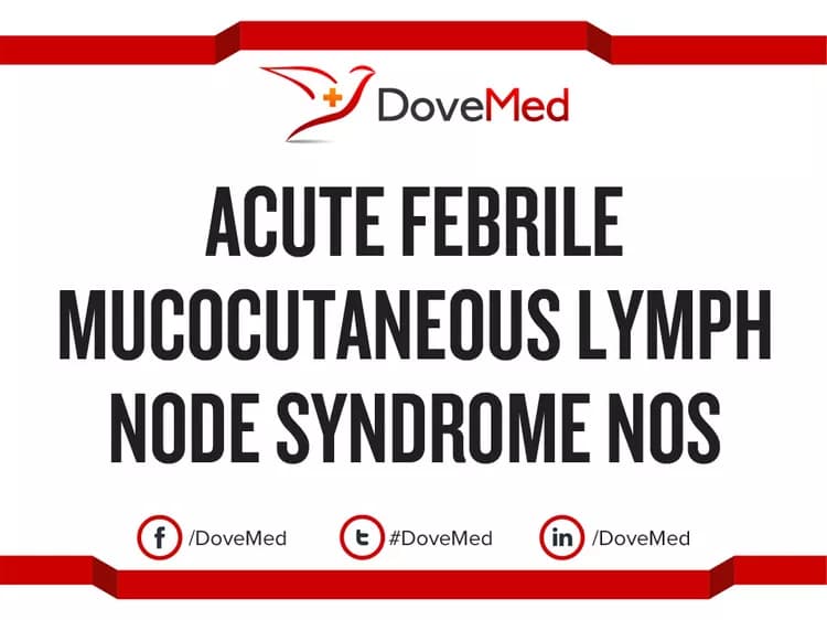 Acute Febrile Mucocutaneous Lymph Node Syndrome NOS (Disorder)