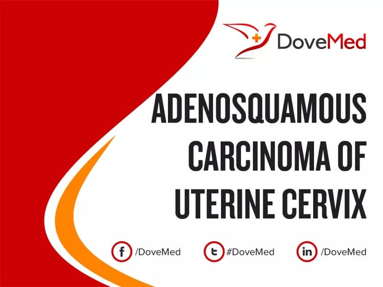 Is the cost to manage Adenosquamous Carcinoma of Uterine Cervix in your community affordable?