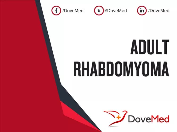 Facts about Adult Rhabdomyoma