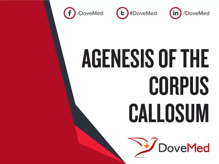 Is the cost to manage Agenesis of the Corpus Callosum in your community affordable?