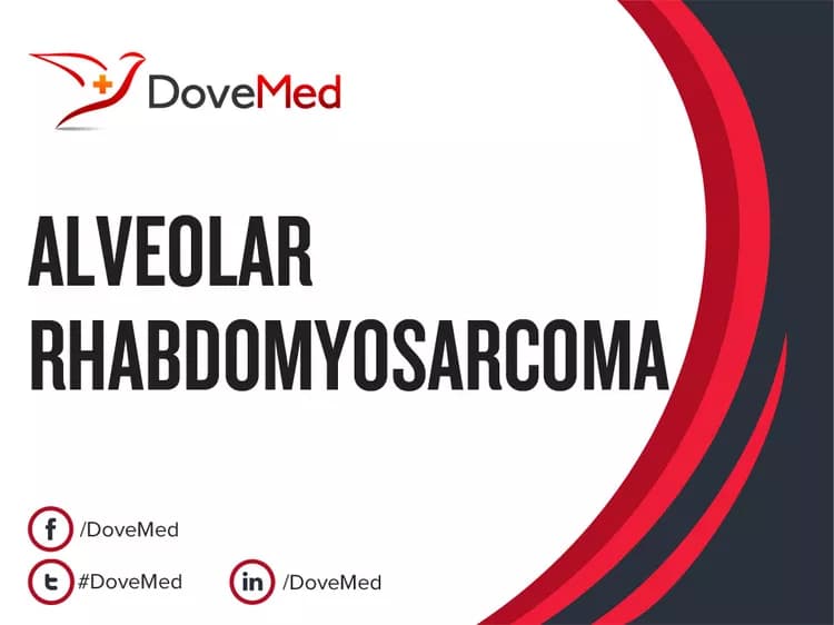 Can you access healthcare professionals in your community to manage Alveolar Rhabdomyosarcoma (ARMS)?