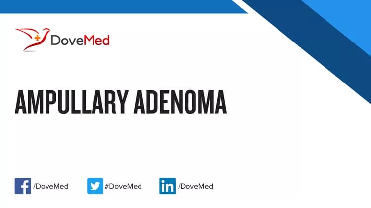 Can you access healthcare professionals in your community to manage Ampullary Adenoma?