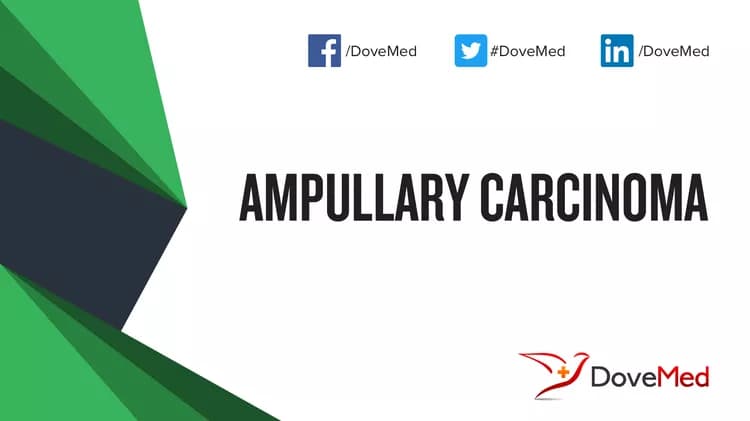 Is the cost to manage Ampullary Carcinoma in your community affordable?