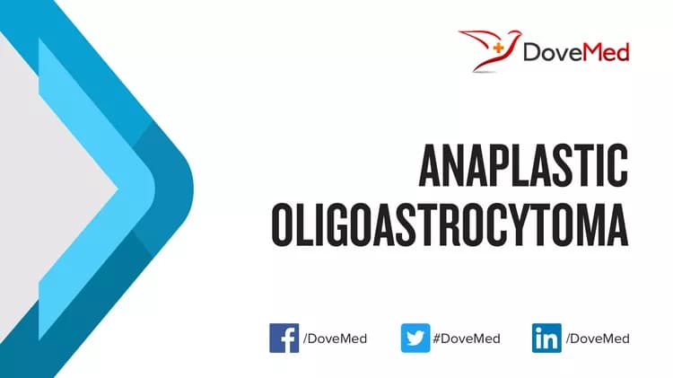 Anaplastic Oligoastrocytoma