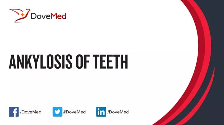 Can you access healthcare professionals in your community to manage Ankylosis of Teeth?