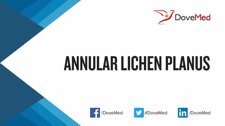 Can you access healthcare professionals in your community to manage Annular Lichen Planus?