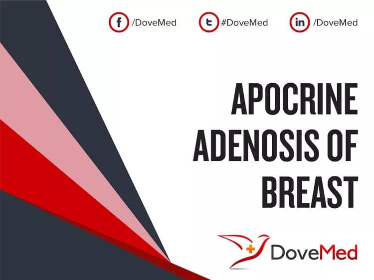 Are you satisfied with the quality of care to manage Apocrine Adenosis of Breast in your community?