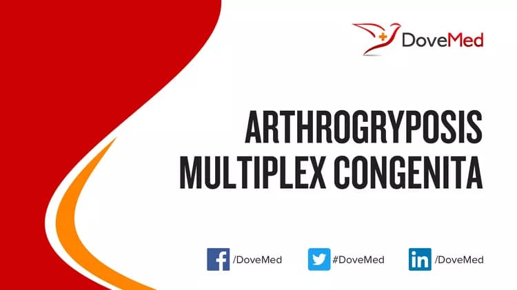 Can you access healthcare professionals in your community to manage Arthrogryposis Multiplex Congenita?