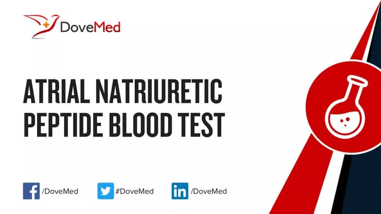 Atrial Natriuretic Peptide Blood Test
