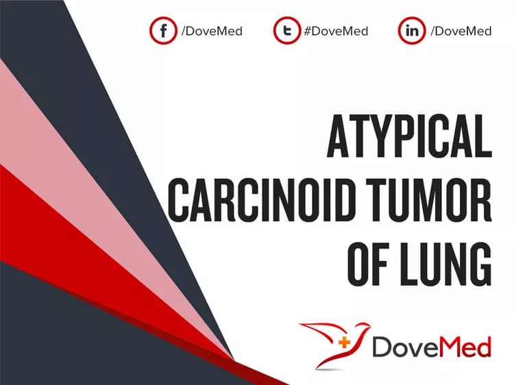 Atypical Carcinoid Tumor of Lung