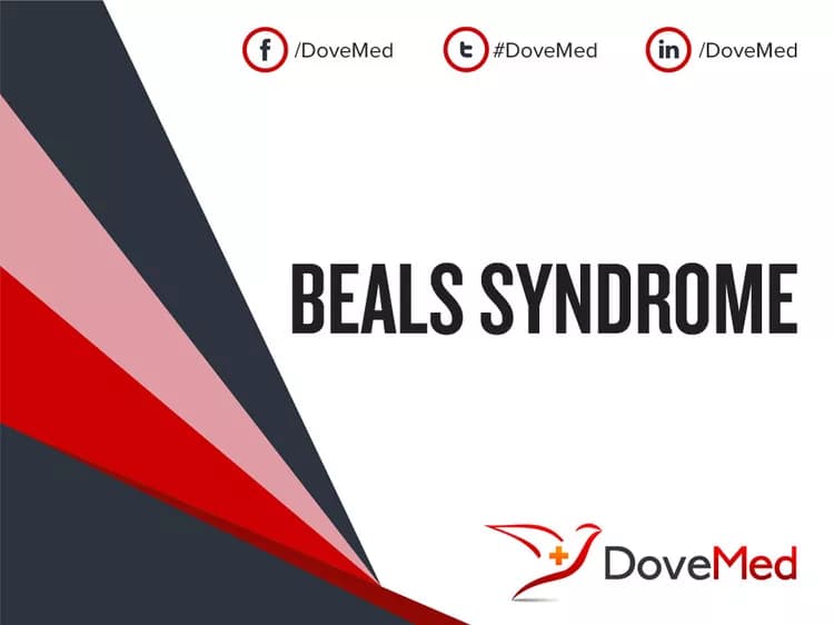 Beals Syndrome