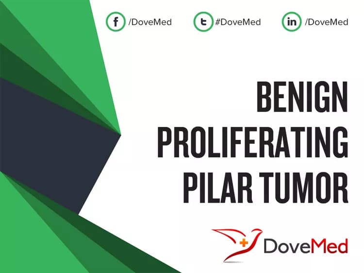 Benign Proliferating Pilar Tumor