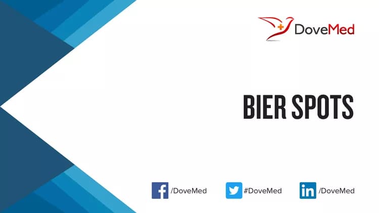 Can you access healthcare professionals in your community to manage Bier Spots?