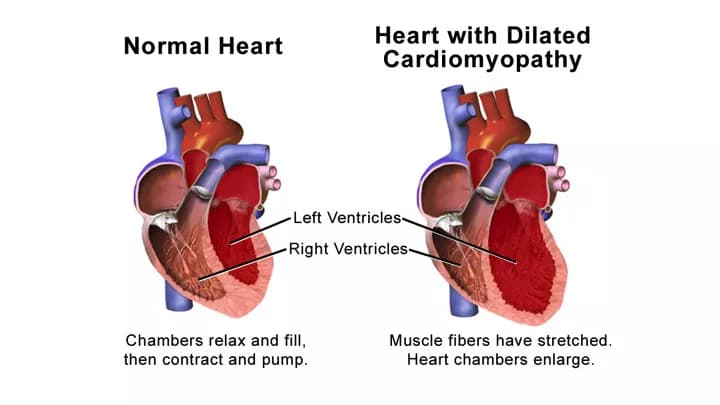 Blausen.com staff. "Blausen gallery 2014