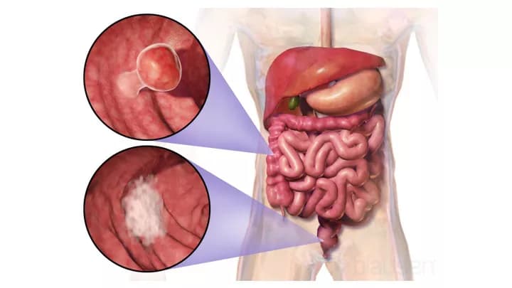 Blausen Medical Communications, Inc.