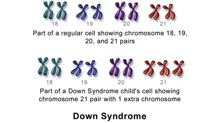 Blausen.com staff. "Blausen gallery 2014