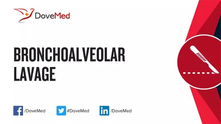 How well do you know Bronchoalveolar Lavage?