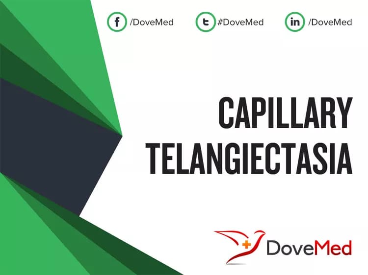 Are you satisfied with the quality of care to manage Capillary Telangiectasia in your community?