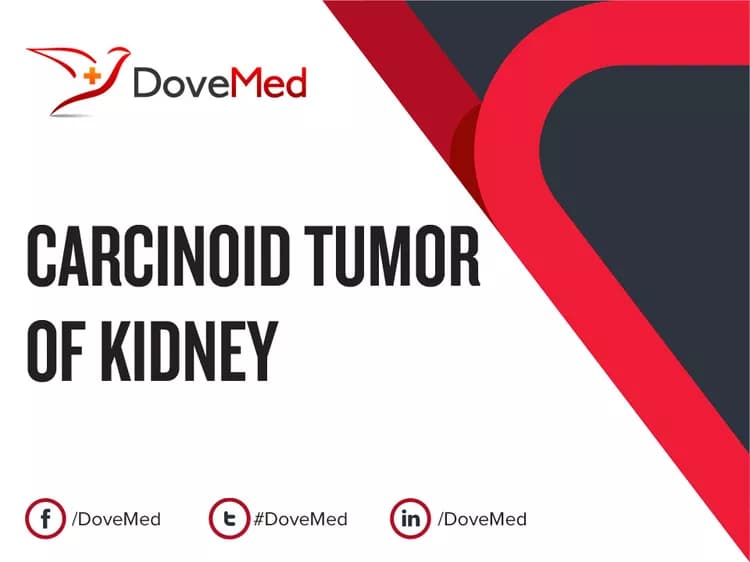 Carcinoid Tumor of Kidney
