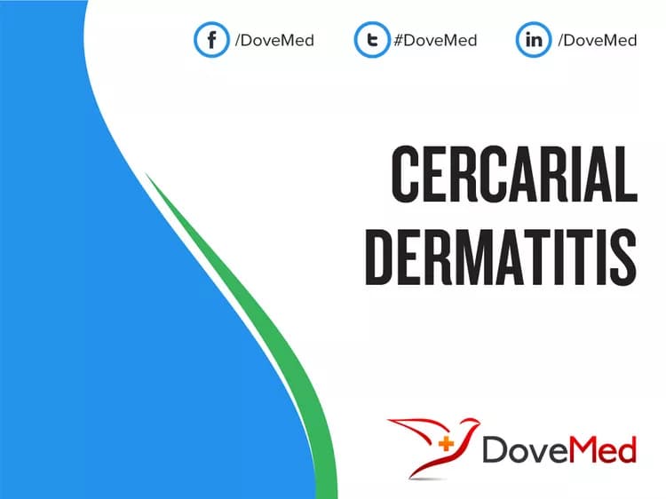 Cercarial Dermatitis