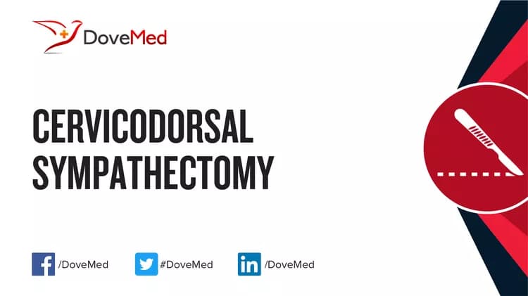 Cervicodorsal Sympathectomy