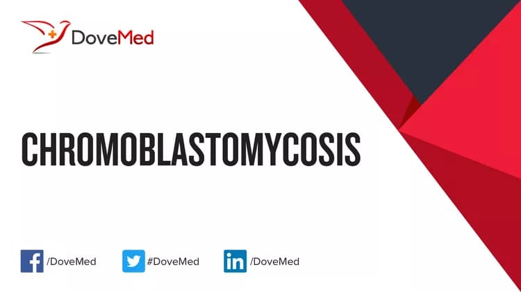 Can you access healthcare professionals in your community to manage Chromoblastomycosis?