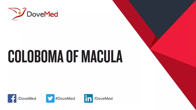Can you access healthcare professionals in your community to manage Coloboma of Macula?
