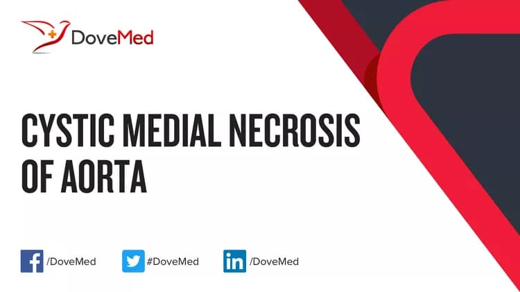 Can you access healthcare professionals in your community to manage Cystic Medial Necrosis of Aorta?