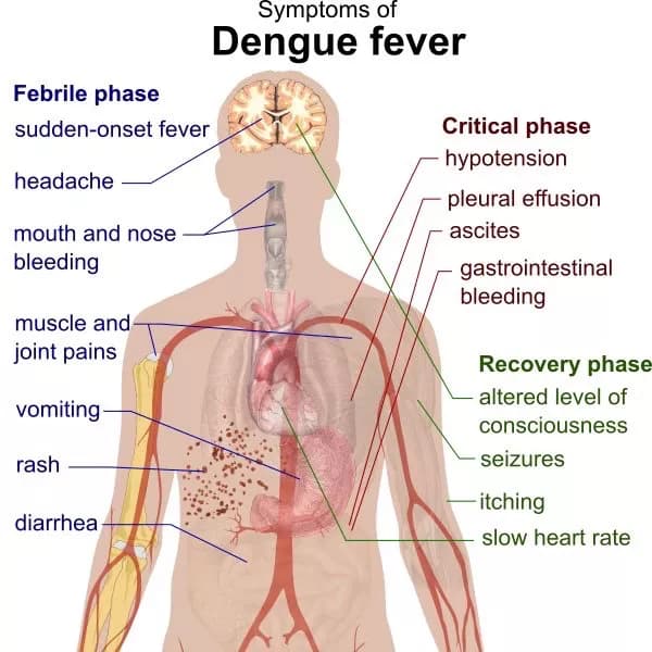 Anemia May Contribute To The Spread Of Dengue Fever