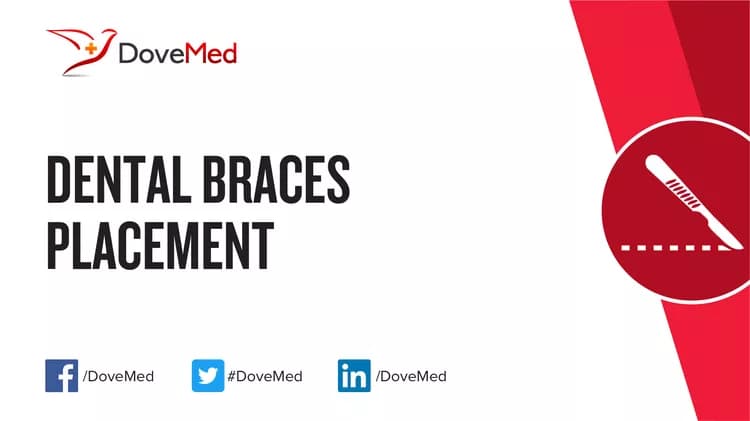Dental Braces Placement