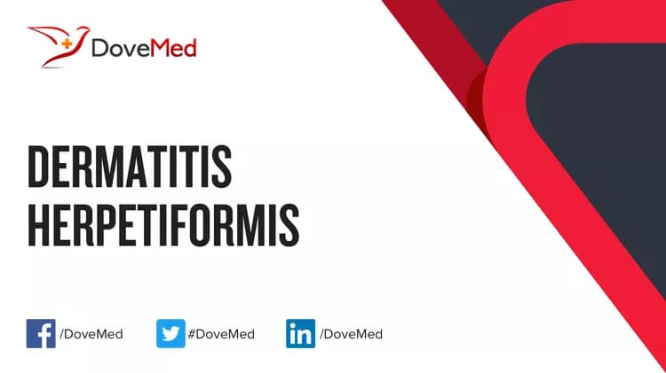 Is the cost to manage Dermatitis Herpetiformis in your community affordable?