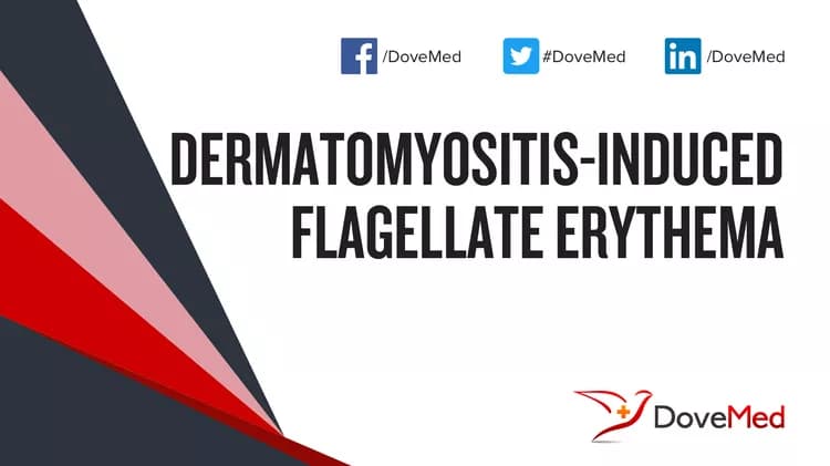 Can you access healthcare professionals in your community to manage Dermatomyositis?