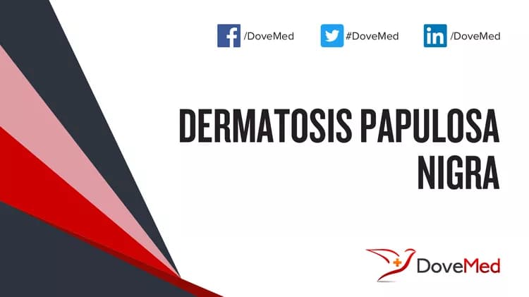 Do you know that Dermatosis Papulosa Nigra is a fairly common benign condition that can cause multiple skin lesions on the face?