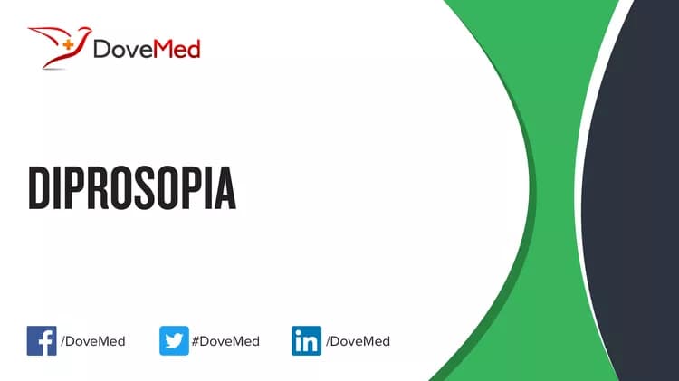 Can you access healthcare professionals in your community to manage Diprosopia?