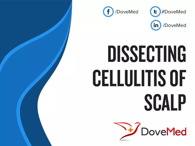 Dissecting Cellulitis of Scalp