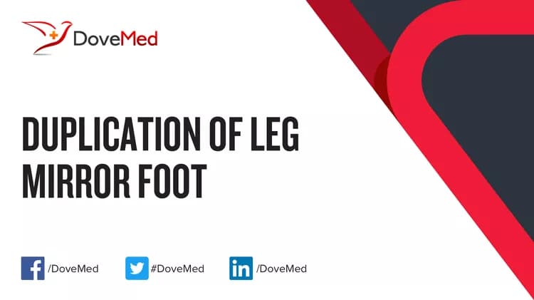 Is the cost to manage Duplication of Leg Mirror Foot in your community affordable?