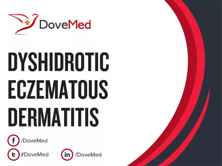 Can you access healthcare professionals in your community to manage Dyshidrotic Eczematous Dermatitis?