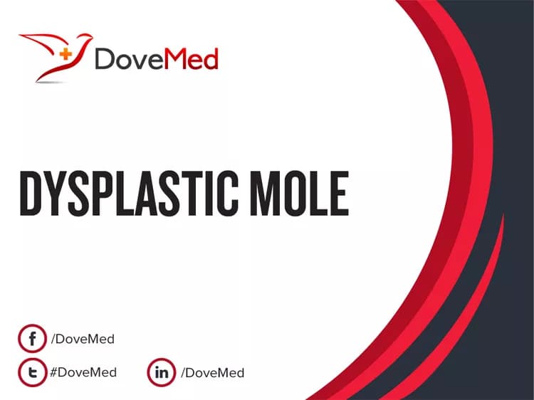 Can you access healthcare professionals in your community to manage Dysplastic Mole?