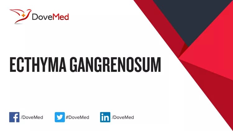 Can you access healthcare professionals in your community to manage Ecthyma Gangrenosum?
