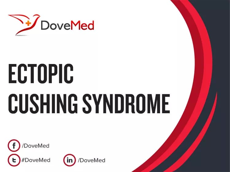 Can you access healthcare professionals in your community to manage Ectopic Cushing Syndrome?