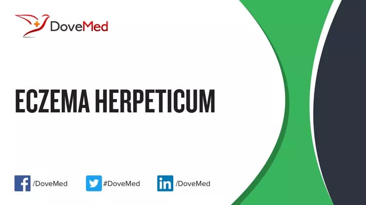 Can you access healthcare professionals in your community to manage Eczema Herpeticum?