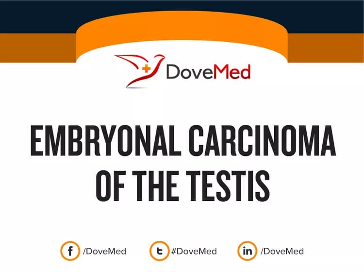 Can you access healthcare professionals in your community to manage Embryonal Carcinoma of the Testis?