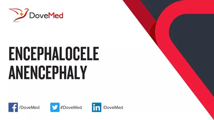 Can you access healthcare professionals in your community to manage Encephalocele?