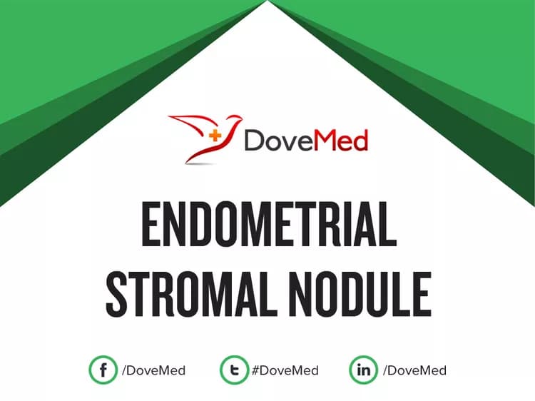 Can you access healthcare professionals in your community to manage Endometrial Stromal Nodule?