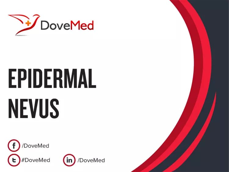 Is the cost to manage Epidermal Nevus (EN) in your community affordable?